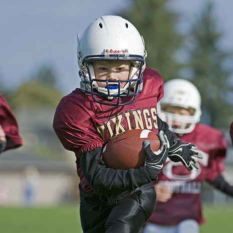 mouthguards